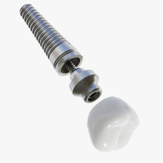 Dental Implant Animation 3D Model .c4d .max .obj .3ds .fbx .stl .blend 