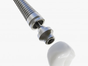 Dental Implant Animation 3D Model
