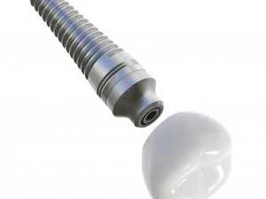 Dental Implant Animation 3D Model