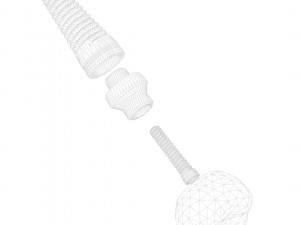 Dental Implant Animation 3D Model