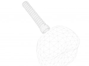 Dental Implant Animation 3D Model