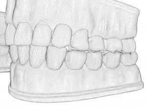 Molde para dentaduras Modelo 3D
