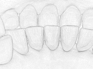 Molde para dentaduras Modelo 3D