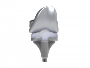 Knee Replacement Implant 3D Model