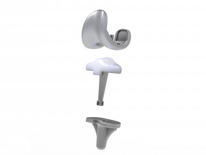 Knee Replacement Implant 3D Model