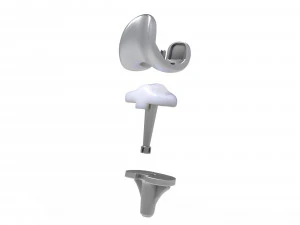 Implante de substitui&ccedil;&atilde;o de joelho Modelo 3D
