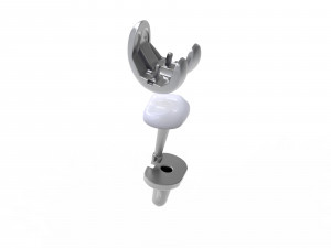 Knee Replacement Implant 3D Model