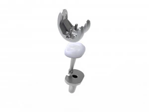 Implante de substitui&ccedil;&atilde;o de joelho Modelo 3D