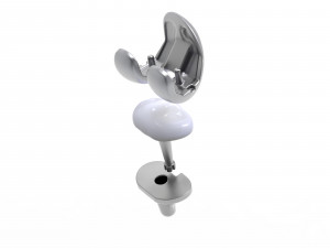 Knee Replacement Implant 3D Model