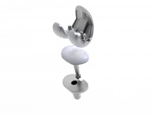 Implante de substitui&ccedil;&atilde;o de joelho Modelo 3D