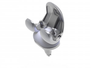 Knee Replacement Implant 3D Model