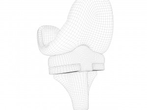 Knee Replacement Implant 3D Model