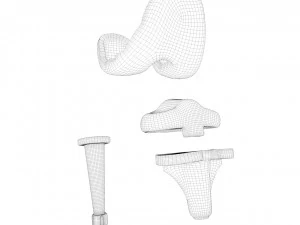Implante de substitui&ccedil;&atilde;o de joelho Modelo 3D