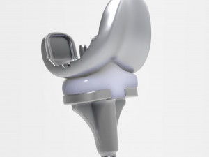 Knee Replacement Modello 3D