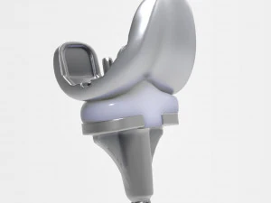 膝关节置换术 3D 模型