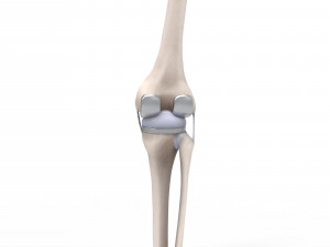 Knee Replacement Modello 3D