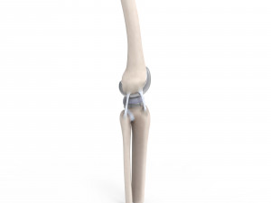 Knee Replacement Modello 3D