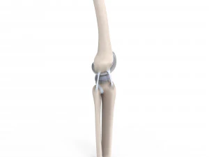 膝关节置换术 3D 模型