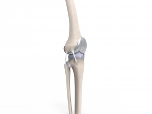 Knee Replacement Modello 3D