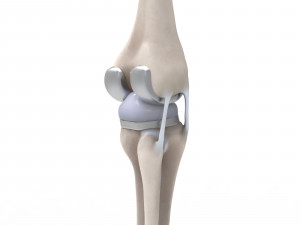 Knee Replacement Modello 3D