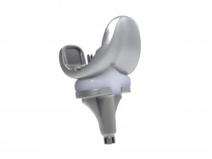 膝关节置换术 3D 模型