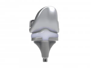 膝关节置换术 3D 模型