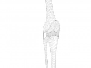 Knee Replacement Modello 3D