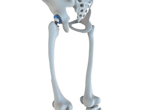 Hip replacement implant installed in the pelvis bone 3D Модель