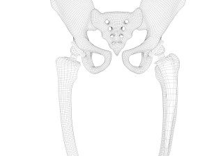 Hip replacement implant installed in the pelvis bone 3D Модель