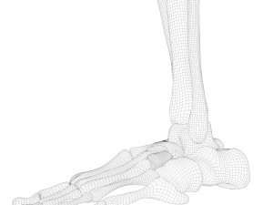 Hip replacement implant installed in the pelvis bone 3D Модель