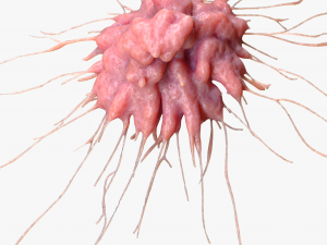 Cancer Cell Tumor 3D Model