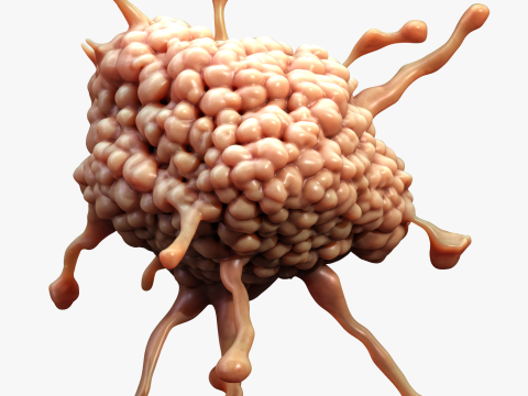 Cancer Cell Tumor Model 3D