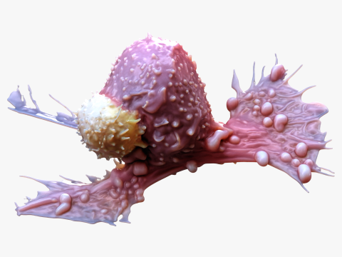Cancer Cell Tumor 3D 模型