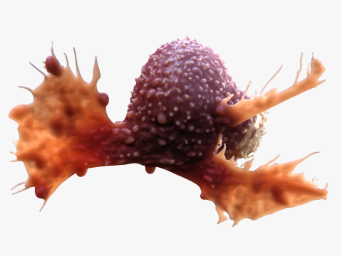 Cancer Cell Tumor 3D Model
