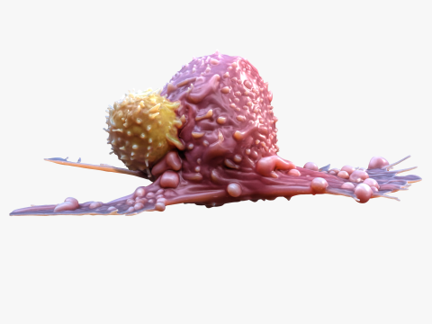 Cancer Cell Tumor 3D Model