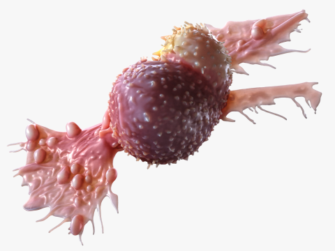 Cancer Cell Tumor 3D Model