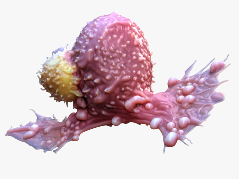 Cancer Cell Tumor 3D Model