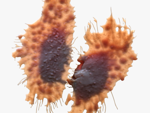 Cancer Cell Tumor Modello 3D
