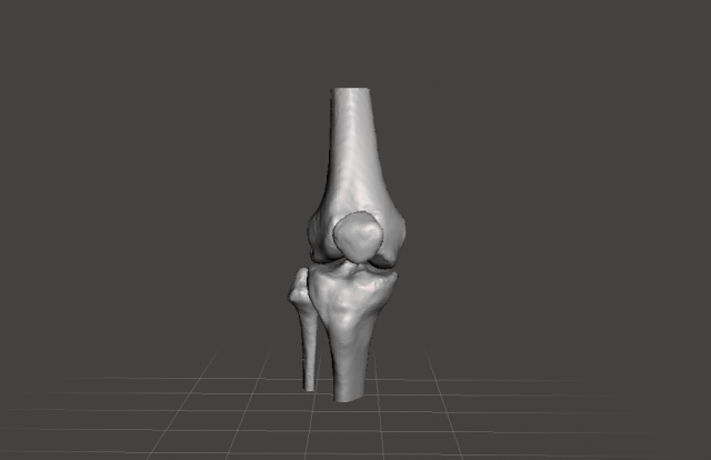 right knee joint - female 3D Model .c4d .max .obj .3ds .fbx .stl .blend 