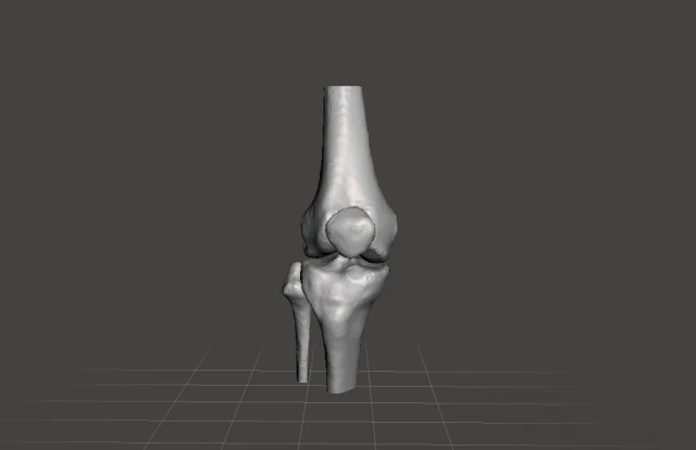 right knee joint - female 3D Model .c4d .max .obj .3ds .fbx .stl .blend