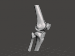 right knee joint - female 3D Model
