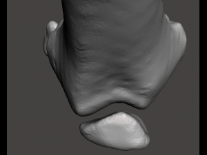 right knee joint - female 3D Model