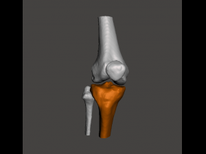 right knee joint - female 3D Model