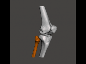 right knee joint - female 3D Model