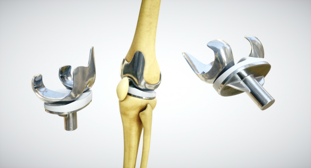 knee endoprosthesis 3D 모델 .c4d .max .obj .3ds .fbx .stl .blend 