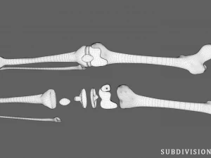 knee endoprosthesis 3D Model