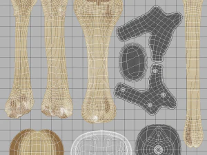 knee endoprosthesis 3D Model