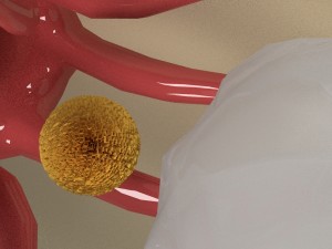 female ovary 3D 모델