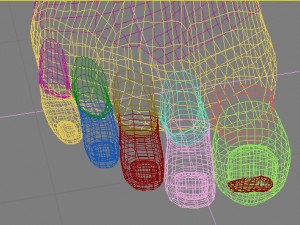 onchomycosis nail fungus Modelo 3D