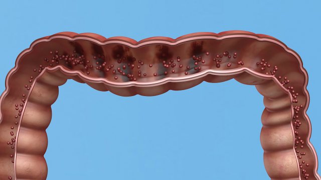 Enterotoxin demonstration internal organs anatomy gastrointestinal Model 3D .c4d .max .obj .3ds .fbx .stl .blend 